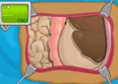 Operate Now! Stomach Surgery